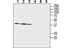 Western blot analysis of human  monocytic leukemia cell line lysate (lanes 1 and 4), human Caco-2 colon adenocarcinoma cell line lysate (lanes 2 and 5) and human  colorectal adenocarcinoma cell line lysate (lanes 3 and 6): 1-3. (NEGR1 抗体  (Extracellular))