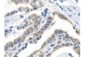 Immunohistochemistry (IHC) image for anti-3-Oxoacid CoA Transferase 1 (OXCT1) (AA 40-489) antibody (ABIN7441481)