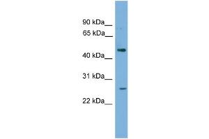 WB Suggested Anti-HLX Antibody Titration: 0. (HLX 抗体  (Middle Region))