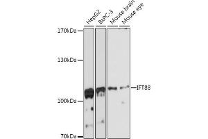 Western blot analysis of extracts of various cell lines, using IFT88 antibody (ABIN6131798, ABIN6142226, ABIN6142227 and ABIN6216899) at 1:3000 dilution. (IFT88 抗体  (AA 534-833))
