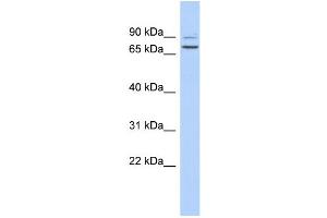 WB Suggested Anti-C9orf75 Antibody Titration: 0. (TPRN 抗体  (Middle Region))