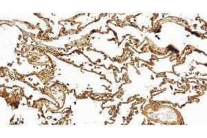 anti-Advanced Glycosylation End Product-Specific Receptor (AGER) (AA 43-404) antibody