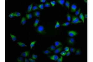 Immunofluorescence staining of Hela cells with ABIN7161453 at 1:133, counter-stained with DAPI. (NTSR2 抗体  (AA 359-410))