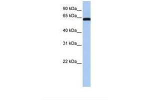 anti-Lectin, Galactoside-Binding, Soluble, 3 Binding Protein (LGALS3BP) (AA 362-411) antibody