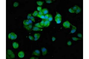 Immunofluorescence staining of MCF-7 cells with ABIN7160049 at 1:100, counter-stained with DAPI. (MAP3K6 抗体  (AA 905-990))