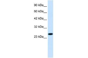 RGS13 antibody used at 1. (RGS13 抗体  (Middle Region))