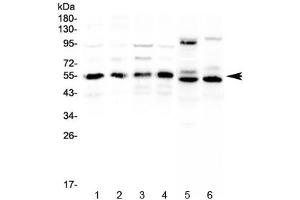 Western blot testing of human 1) HeLa, 2) COLO320, 3) A431, 4) MCF7, 5) rat heart and 6) mouse heart lysate with RXRA antibody at 0. (Retinoid X Receptor alpha 抗体)