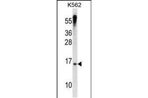 Western blot analysis in K562 cell line lysates (35ug/lane). (MXD3 抗体  (N-Term))