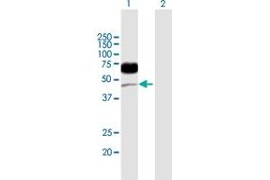 Western Blot analysis of CD96 expression in transfected 293T cell line by CD96 MaxPab polyclonal antibody. (CD96 抗体  (AA 1-402))