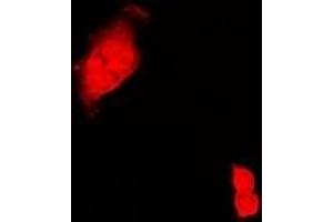 Immunofluorescent analysis of CIRBP staining in Hela cells. (CIRBP 抗体)