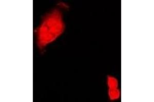 Immunofluorescent analysis of CIRBP staining in Hela cells. (CIRBP 抗体)