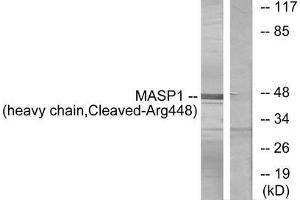 Western blot analysis of extracts from A549 cells, treated with etoposide (25uM, 24hours), using MASP1 (heavy chain, Cleaved-Arg448) antibody. (MASP1 抗体  (Cleaved-Arg448))