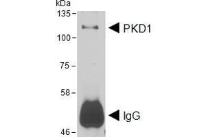 HEK293 lysate overexpressing Human DYKDDDDK-tagged PKD1 was used to immunoprecipitate PKD1 with 2ug ABIN5539576. (PKC mu 抗体  (AA 383-395))