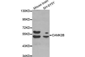 Western blot analysis of extracts of various cell lines, using CAMK2B antibody. (CAMK2B 抗体  (AA 1-300))