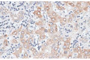 Immunohistochemistry of paraffin-embedded Human liver using GPC4 Polyclonal Antibody at dilution of 1:100 (40x lens). (GPC4 抗体)