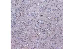 Immunohistochemistry (IHC) image for anti-Glutathione S-Transferase mu 3 (Brain) (GSTM3) antibody (ABIN5708464)