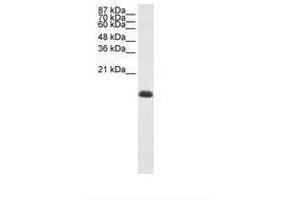 Image no. 2 for anti-Zinc Finger Protein 786 (ZNF786) (N-Term) antibody (ABIN203008) (ZNF786 抗体  (N-Term))