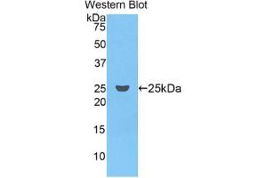 Western blot analysis of the recombinant protein. (Coagulation Factor IX 抗体  (AA 61-263))
