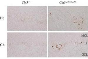 Immunohistochemistry (Paraffin-embedded Sections) (IHC (p)) image for anti-Microtubule-Associated Protein 1 Light Chain 3 beta (MAP1LC3B) (AA 1-30), (N-Term) antibody (ABIN5555711)