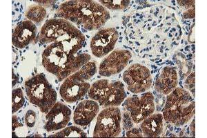 Immunohistochemical staining of paraffin-embedded Human Kidney tissue using anti-HDAC6 mouse monoclonal antibody. (HDAC6 抗体)