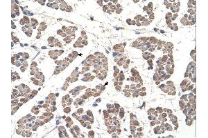 GCDH antibody was used for immunohistochemistry at a concentration of 4-8 ug/ml. (GCDH 抗体  (C-Term))