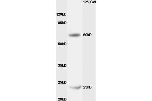 Rat liver lysates probed with Rabbit Anti-CPT1B Polyclonal Antibody (ABIN708851) at 1:200 in 4 °C. (CPT1B 抗体  (AA 501-600))