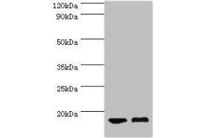 Western blot All lanes: COTL1 antibody at 5 μg/mL Lane 1: Mouse brain tissue Lane 2: Mouse kidney tissue Secondary Goat polyclonal to rabbit IgG at 1/10000 dilution Predicted band size: 16 kDa Observed band size: 16 kDa (COTL1 抗体  (AA 1-142))