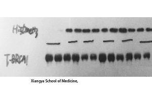 Western Blot (WB) analysis: Please contact us for more details. (BRCA1 抗体  (Ser183))