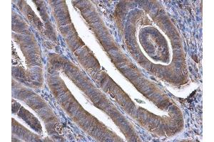 IHC-P Image GBP3 antibody [N1C1] detects GBP3 protein at cytoplasm in human endometrium by immunohistochemical analysis. (GBP3 抗体)