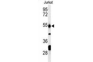 Western Blotting (WB) image for anti-Prune Exopolyphosphatase (PRUNE) antibody (ABIN3004302) (PRUNE 抗体)