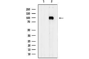 anti-ADAM Metallopeptidase Domain 32 (ADAM32) (C-Term) antibody