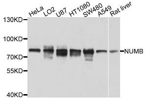 Western blot analysis of extracts of various cell lines, using NUMB antibody (ABIN5996190) at 1/1000 dilution. (NUMB 抗体)