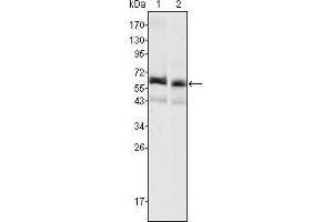 Western blot analysis using AFP mouse mAb against HepG2 (1) and SMMC-7721 (2) cell lysate. (alpha Fetoprotein 抗体)