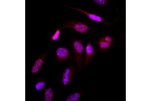 Immunofluorescence (IF) image for anti-Small Ubiquitin Related Modifier 2 (SUMO2) (AA 1-93), (N-Term) antibody (ABIN492387) (SUMO2 抗体  (N-Term))