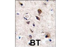 Formalin-fixed and paraffin-embedded human brain tissue reacted with PKC gamma antibody (C-term), which was peroxidase-conjugated to the secondary antibody, followed by DAB staining. (PKC gamma 抗体  (C-Term))