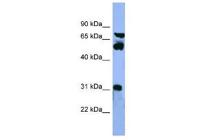 WB Suggested Anti-CYP8B1 Antibody Titration: 0. (CYP8B1 抗体  (Middle Region))