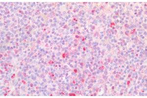 Detection of BST1 in Human Spleen Tissue using Polyclonal Antibody to Bone Marrow Stromal Cell Antigen 1 (BST1) (BST1 抗体  (AA 63-313))