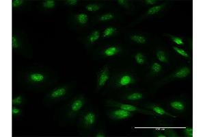 Immunofluorescence of monoclonal antibody to FBXO7 on HeLa cell. (FBXO7 抗体  (AA 357-455))