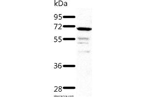 Western blot analysis of Human fetal kidney tissue, using TRAF3 Polyclonal Antibody at dilution of 1:500 (TRAF3 抗体)