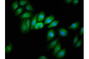 Immunofluorescence staining of A549 cells with ABIN7157473 at 1:166, counter-stained with DAPI. (CRYM 抗体  (AA 169-258))