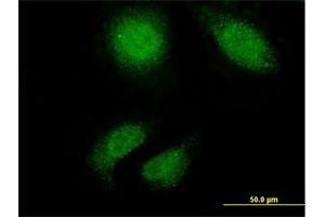 Immunofluorescence of monoclonal antibody to TTN on HeLa cell. (Titin 抗体  (AA 1-110))