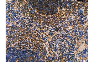 ABIN6262672 and ABIN6276585 at 1/100 staining Rat spleen tissue by IHC-P. (ISG15 抗体  (C-Term))