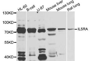 Western blot analysis of extracts of various cells, using IL5RA antibody. (IL5RA 抗体)