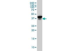 EIF4E2 monoclonal antibody (M02), clone 1A11 Western Blot analysis of EIF4E2 expression in MCF-7 .