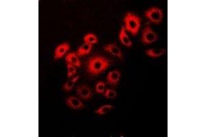 Immunofluorescent analysis of VAP-B/C staining in Hela cells. (VAPB 抗体)