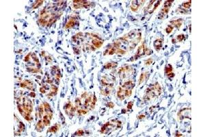 IHC testing of FFPE human uterus with recombinant Caldesmon antibody (clone CALD1/1424R). (Recombinant Caldesmon HMW 抗体)