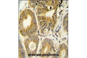 Immunohistochemistry (Paraffin-embedded Sections) (IHC (p)) image for anti-ADP-Ribosylation Factor-Like 8A (ARL8A) (AA 116-142) antibody (ABIN654121)