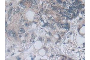 Immunohistochemistry (IHC) image for anti-Methylenetetrahydrofolate Reductase (NAD(P)H) (MTHFR) (AA 1-325) antibody (ABIN7436504)