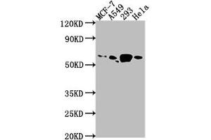 Western Blot Positive WB detected in: MCF-7 whole cell lysate, A549 whole cell lysate, 293 whole cell lysate, Hela whole cell lysate All lanes: PDE1B antibody at 1:1000 Secondary Goat polyclonal to rabbit IgG at 1/50000 dilution Predicted band size: 62, 60 kDa Observed band size: 62 kDa (PDE1B 抗体  (AA 1-277))