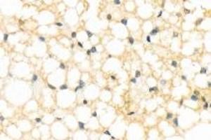 Immunohistochemistry analysis of paraffin-embedded rat brown fat using,Resistin (ABIN7075402) at dilution of 1: 800 (Resistin 抗体)
